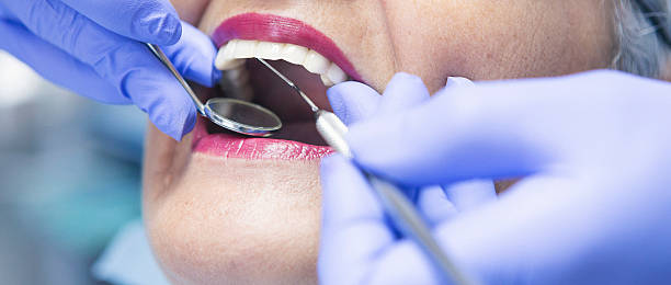 Best Emergency Tooth Extraction in Central Gardens, TX