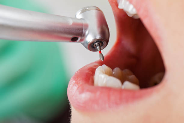 Best Emergency Dental Surgery in Central Gardens, TX